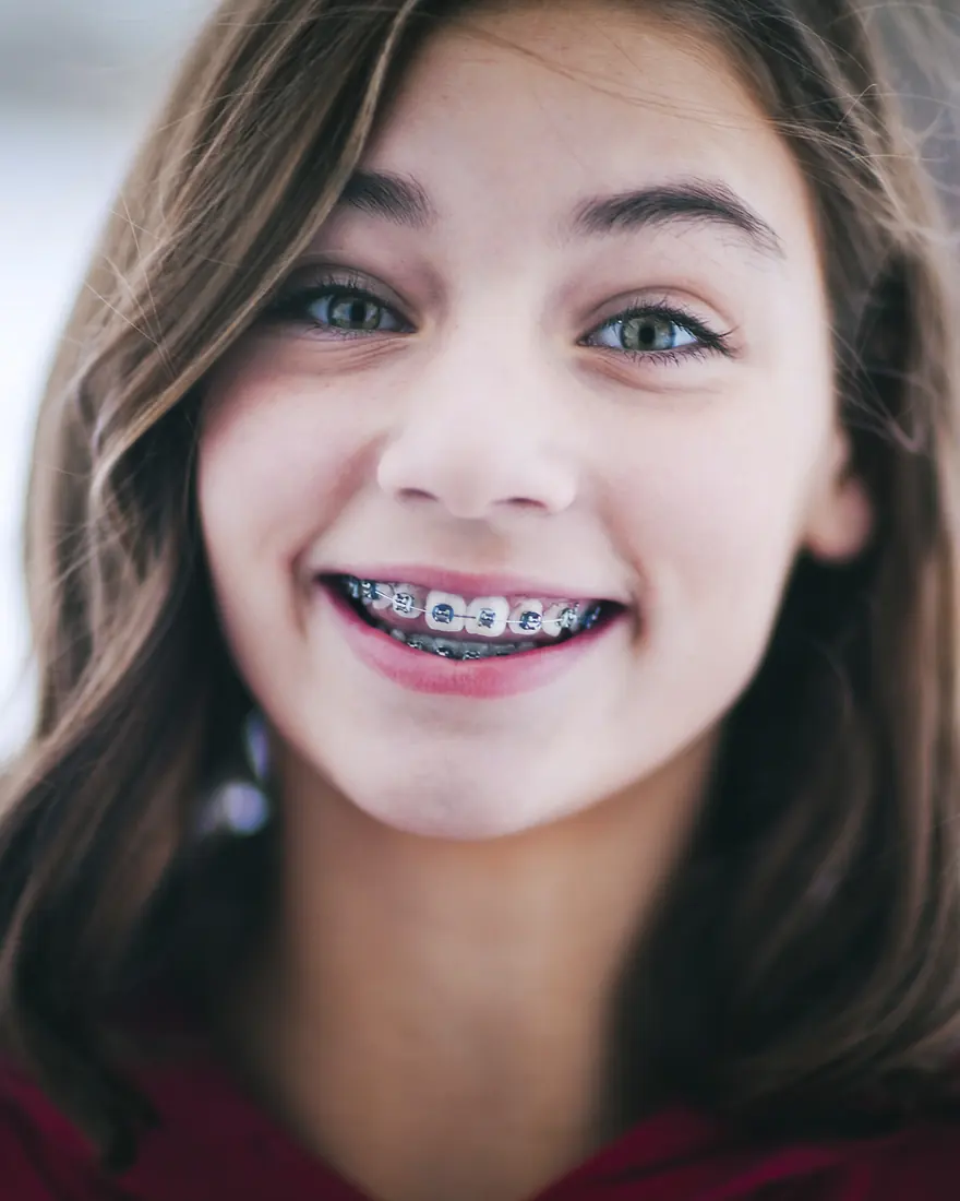 A close-up of a teen smiling with braces